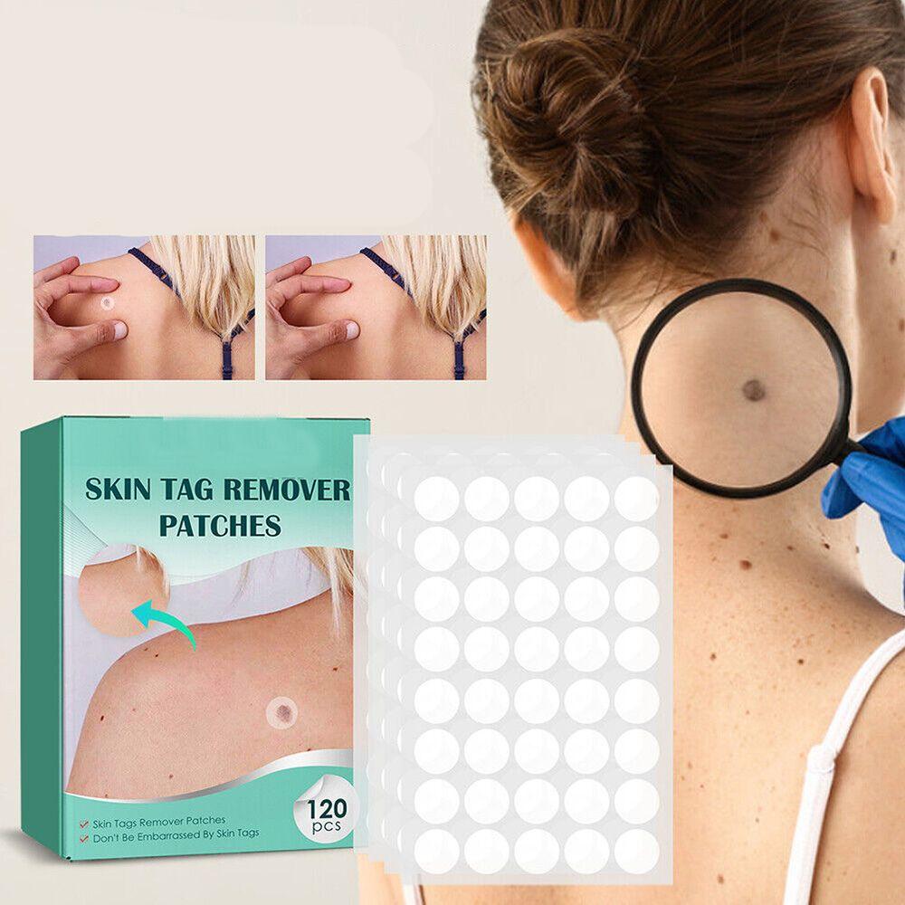 DermaClear – Effektivt behandlingssett for kviser og vorter